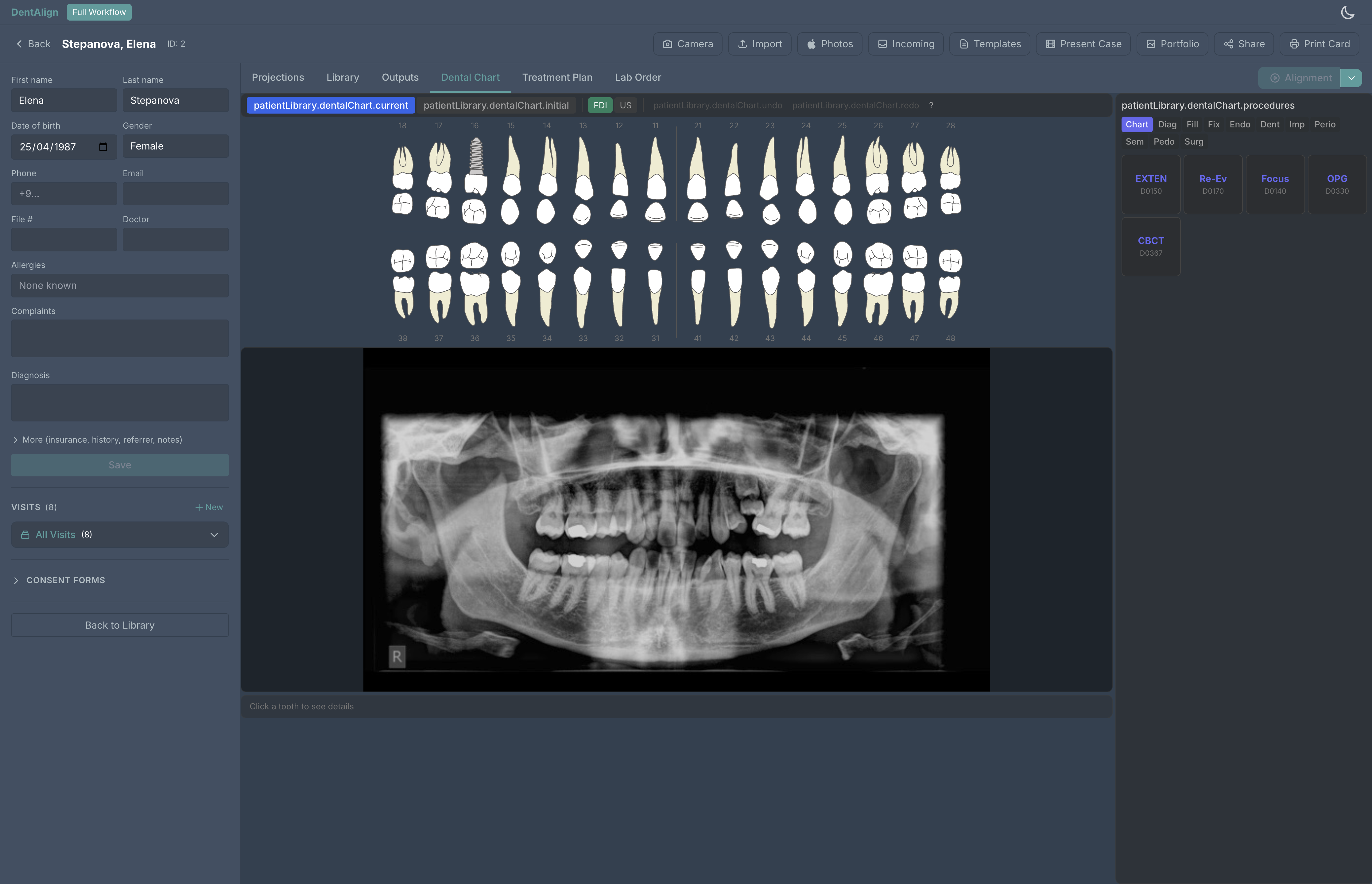 DentAlign patient card with dental chart