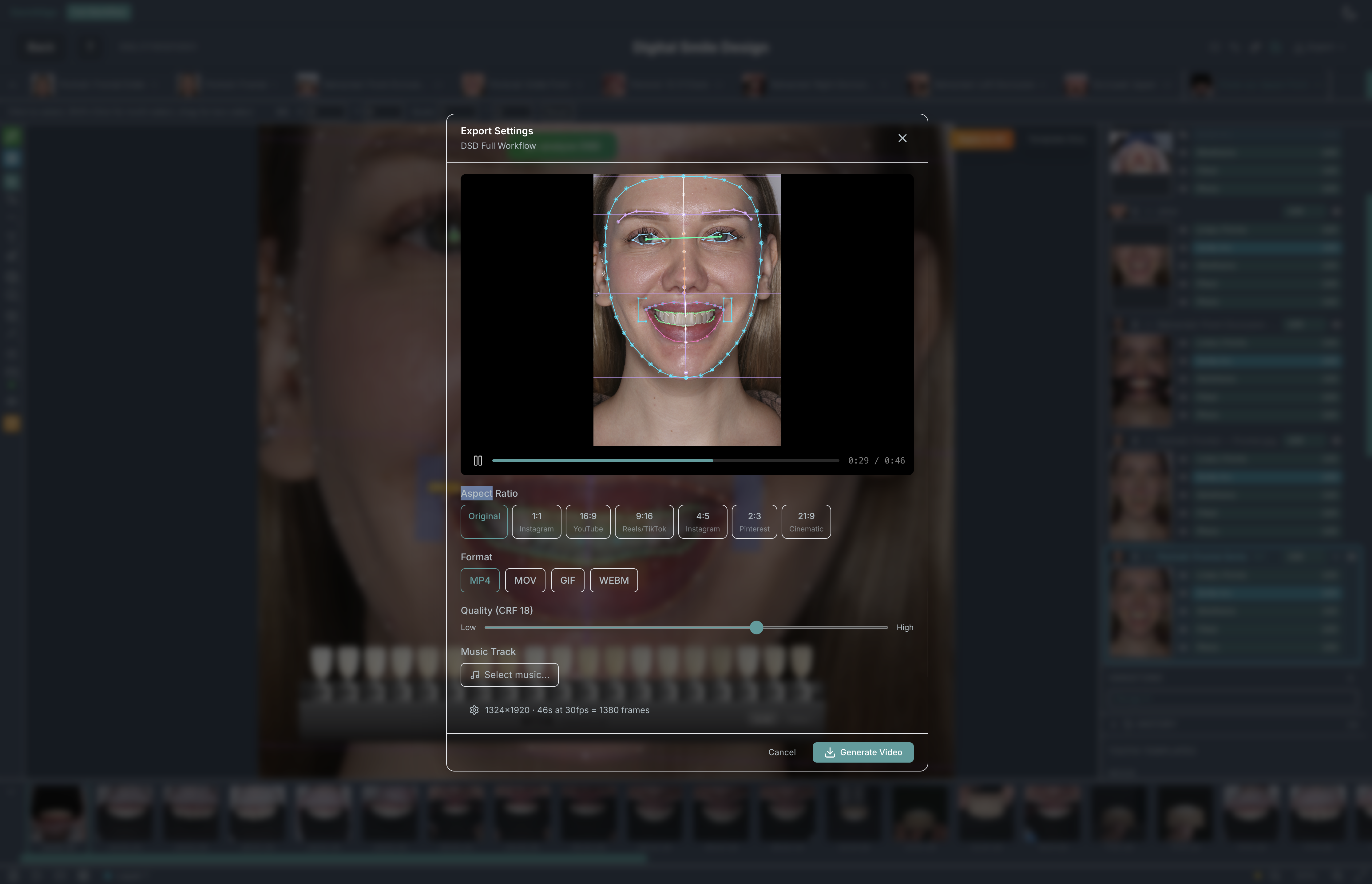 DentAlign DSD export settings