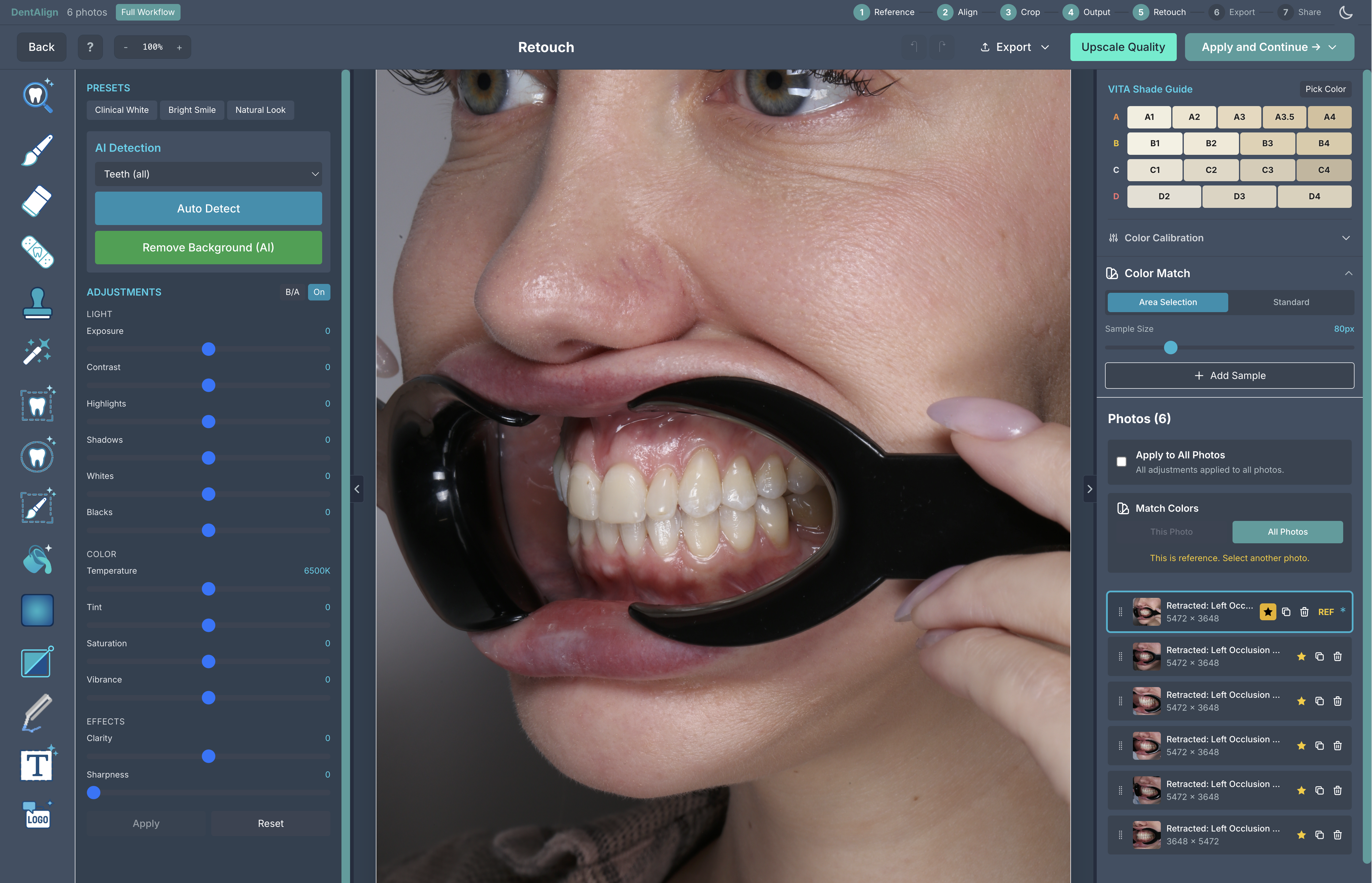 DentAlign retouch tools