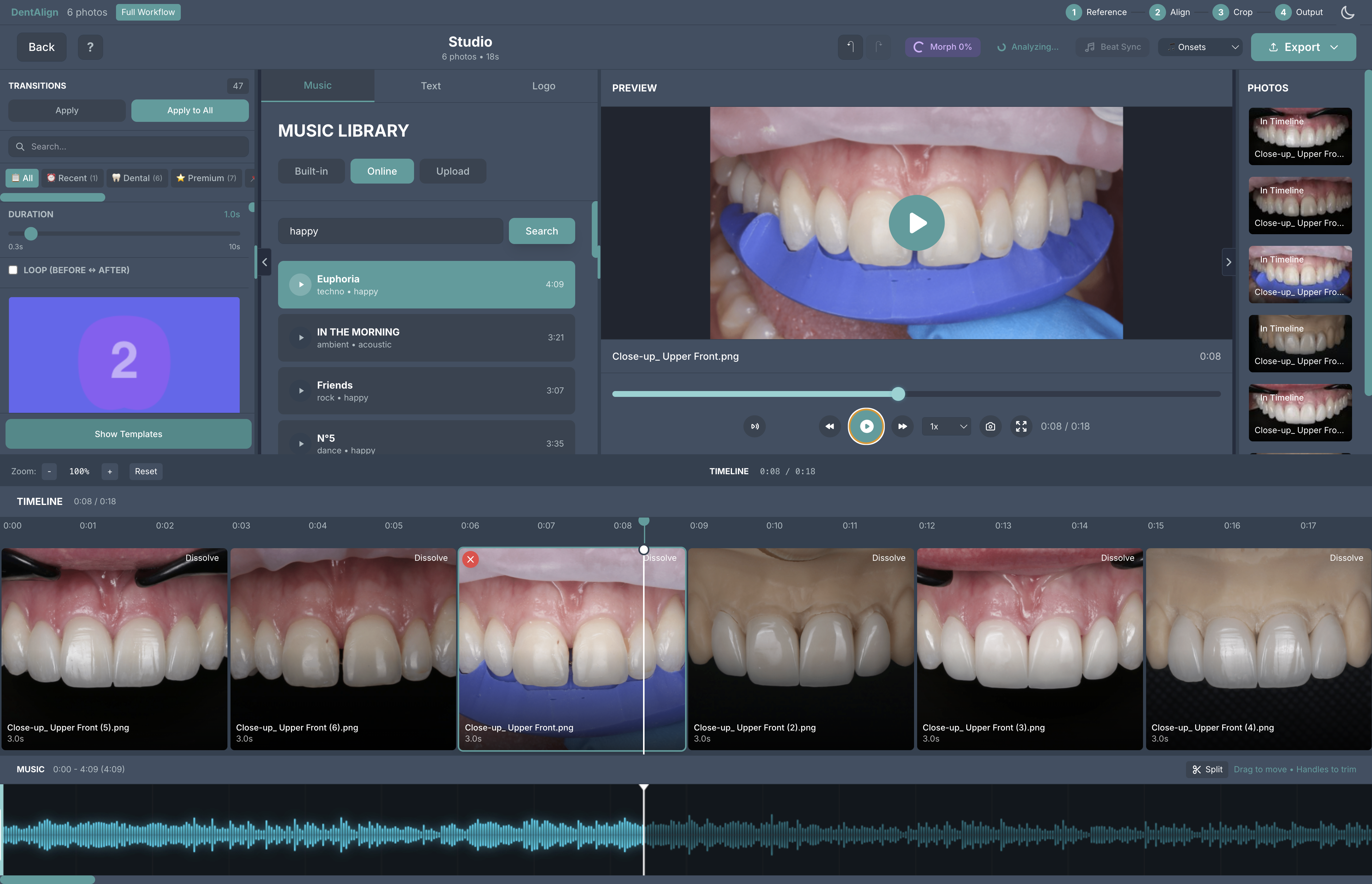 DentAlign video studio